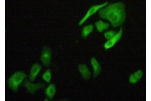 Figure:FITC staining on IHC-P Simple: Hela cells (FLNB antibody  (AA 1175-1457))