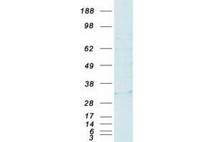 Validation with Western Blot (HLA-DMB Protein (Myc-DYKDDDDK Tag))