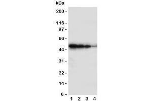 Western blot testing of BMPR1B antbody;  Lane 1: Recombinant human protein 10ng;  2: 5ng;  3: 2. (BMPR1B antibody  (Middle Region))
