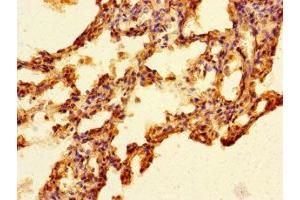 Immunohistochemistry of paraffin-embedded human lung tissue using ABIN7165390 at dilution of 1:100 (FAM131A antibody  (AA 1-281))
