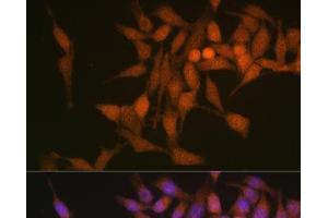Immunofluorescence analysis of HeLa cells using PSMB6 Polyclonal Antibody at dilution of 1:100 (40x lens). (PSMB6 antibody)