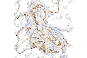 Immunohistochemistry (IHC) image for anti-Melanoma Cell Adhesion Molecule (MCAM) (AA 447-646) antibody (ABIN6143621)