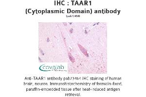Image no. 1 for anti-Trace Amine Associated Receptor 1 (TAAR1) (3rd Cytoplasmic Domain) antibody (ABIN1739854) (TAAR1 antibody  (3rd Cytoplasmic Domain))