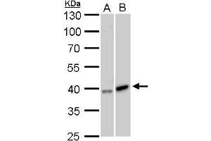 WB Image GALK1 antibody detects GALK1 protein by Western blot analysis. (GALK1 antibody)
