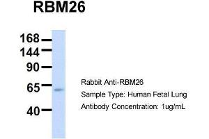 Host:  Rabbit  Target Name:  RBM26  Sample Type:  Human Fetal Lung  Antibody Dilution:  1. (RBM26 antibody  (Middle Region))