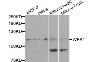 Western blot analysis of extracts of various cells, using WFS1 antibody. (WFS1 antibody)