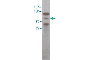 Western blot using Stat5a polyclonal antibody  shows detection of Stat5a protein in HeLa cell extract (arrowhead). (STAT5A antibody  (C-Term))