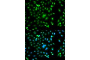 Immunofluorescence analysis of A549 cells using ELF5 antibody.