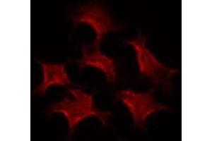 Immunofluorescence (fixed cells) (IF/ICC) image for anti-ATPase, Cu++ Transporting, beta Polypeptide (ATP7B) (C-Term) antibody (ABIN6256919)