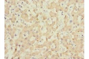 Immunohistochemistry of paraffin-embedded human liver tissue using ABIN7143271 at dilution of 1:100 (ADAMTSL4 antibody  (AA 795-1074))