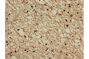 Immunohistochemistry of paraffin-embedded human brain tissue using ABIN7142928 at dilution of 1:100