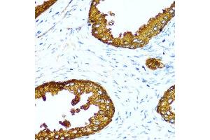 Immunohistochemistry of paraffin-embedded human prostate using ACPP antibody at dilution of 1:100 (40x lens). (ACPP antibody)
