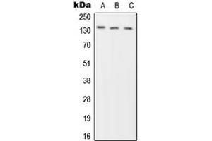 Western blot analysis of Phogrin expression in HeLa (A), SP2/0 (B), H9C2 (C) whole cell lysates. (PTPRN2 antibody  (Center))