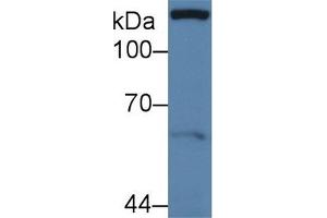 Detection of PXN in Human MCF7 cell lysate using Polyclonal Antibody to Paxillin (PXN) (Paxillin antibody  (AA 201-461))