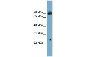 WB Suggested Anti-SLC6A5  Antibody Titration: 0. (SLC6A5 antibody  (Middle Region))
