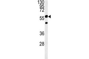 PHGDH antibody western blot analysis in Ramos lysate. (PHGDH antibody  (AA 249-277))