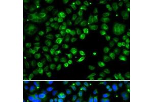 Immunofluorescence analysis of MCF-7 cells using TXNDC5 Polyclonal Antibody (TXNDC5 antibody)