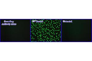 DNA Damage Induced by UV Light in Hela Cells. (Cellular UV-Induced DNA Damage ELISA Kit)