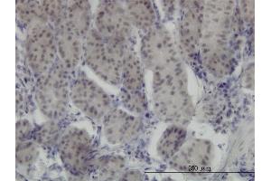 Immunostaining (ISt) image for anti-Runt-Related Transcription Factor 1 (RUNX1) (AA 210-310) antibody (ABIN514054)