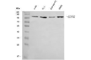 Western blot analysis of Axin 2/AXIN2 using anti-Axin 2/AXIN2 antibody (ABIN7602177).
