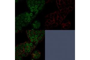 Confocal immunofluorescence image of MCF-7 cells using CHD4 Mouse Monoclonal Antibody (3F2/4) stained in Green (CF488) and Phalloidin is used to label the membranes. (CHD4 antibody  (C-Term))