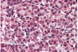 Human Pancreas (formalin-fixed, paraffin-embedded) stained with GPC4 antibody ABIN351425 at 5-10 ug/ml followed by biotinylated goat anti-rabbit IgG secondary antibody ABIN481713, alkaline phosphatase-streptavidin and chromogen. (GPC4 antibody  (Internal Region))