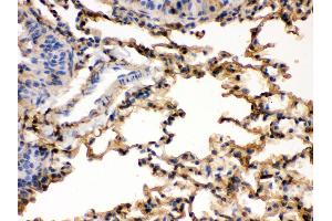 Immunohistochemistry (Paraffin-embedded Sections) (IHC (p)) image for anti-S100 Calcium Binding Protein A6 (S100A6) (AA 1-90) antibody (ABIN3043320) (S100A6 antibody  (AA 1-90))