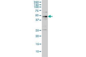 PHF1 monoclonal antibody (M01), clone 2D3 Western Blot analysis of PHF1 expression in A-431 . (PHF1 antibody  (AA 2-100))