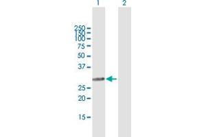 Western Blot analysis of SMNDC1 expression in transfected 293T cell line by SMNDC1 MaxPab polyclonal antibody. (SMNDC1 antibody  (AA 1-238))