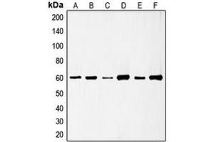 Western blot analysis of c-SRC (pS75) expression in HeLa (A), HuvEc (B), Jurkat (C), COLO205 (D), HEK293T EGF-treated (E), A431 pervanadate-treated (F) whole cell lysates. (Src antibody  (N-Term, pSer75))