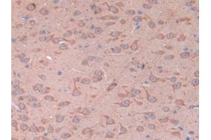 IHC-P analysis of Mouse Cerebrum Tissue, with DAB staining. (CD38 antibody  (AA 54-301))