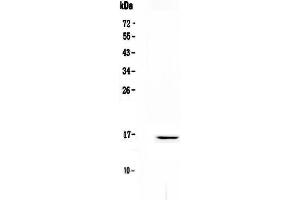 Western blot analysis of Niemann Pick C2 using anti-Niemann Pick C2 antibody .