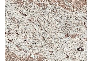 Immunohistochemistry analysis using Rabbit Anti-LRP1 Polyclonal Antibody (ABIN5696030). (LRP1 antibody  (AA 160-260))