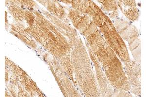 ABIN6274975 at 1/100 staining human skeletal muscle tissue sections by IHC-P.