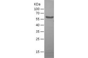 Western Blotting (WB) image for Dihydropyrimidinase-Like 5 (DPYSL5) (AA 364-564) protein (His-IF2DI Tag) (ABIN7122668) (DPYSL5 Protein (AA 364-564) (His-IF2DI Tag))
