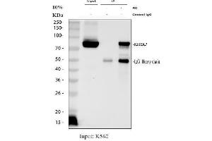 Immunoprecipitating (IP) KHSRP in K562 whole cell lysate.