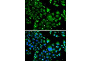 Immunofluorescence analysis of MCF-7 cells using WBSCR22 antibody (ABIN4905616). (WBSCR22 antibody)