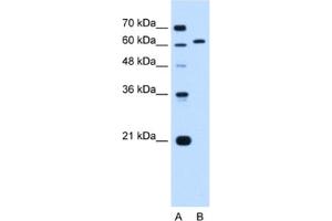 Western Blotting (WB) image for anti-Lamin B2 (LMNB2) antibody (ABIN2462974) (Lamin B2 antibody)