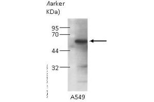WB Image Sample (30 ug of whole cell lysate) A: 293T B: HepG2, C: Molt-4 , 7. (KPNA4 antibody  (C-Term))