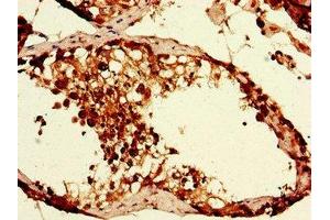 Immunohistochemistry of paraffin-embedded human testis tissue using ABIN7152373 at dilution of 1:100 (CAPZA1 antibody  (AA 211-252))