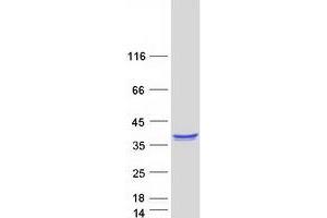 Validation with Western Blot