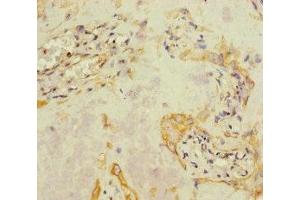 Immunohistochemistry of paraffin-embedded human placenta tissue using ABIN7157836 at dilution of 1:100 (A4GALT antibody  (AA 244-353))