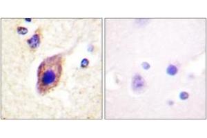 Immunohistochemistry analysis of paraffin-embedded human brain tissue, using PLCG2 (Ab-1217) Antibody. (Phospholipase C gamma 2 antibody  (AA 1186-1235))