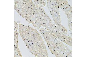 Immunohistochemistry of paraffin-embedded rat heart using HIST1H2AG antibody (ABIN6003627) at dilution of 1/100 (40x lens). (HIST1H2AG antibody)