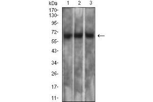 Western blot analysis using MSLN mouse mAb against PC-3 (1), SK-MES-1 (2), and CHO3D10 (3) cell lysate. (Mesothelin antibody  (AA 296-606))