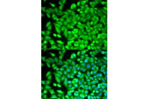 Immunofluorescence analysis of MCF-7 cells using FBP1 antibody (ABIN5973135). (FBP1 antibody)