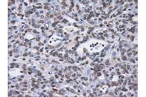 Image no. 13 for anti-ATP Synthase, H+ Transporting, Mitochondrial F1 Complex, beta Polypeptide (ATP5B) antibody (ABIN1496766) (ATP5B antibody)