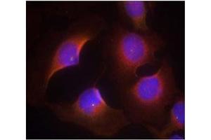 Image no. 3 for anti-Cyclin-Dependent Kinase 6 (CDK6) (pTyr13) antibody (ABIN401597) (CDK6 antibody  (pTyr13))