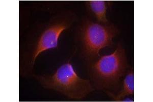 Image no. 3 for anti-Cyclin-Dependent Kinase 6 (CDK6) (pTyr13) antibody (ABIN401596) (CDK6 antibody  (pTyr13))