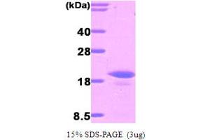 SDS-PAGE (SDS) image for Interleukin 16 (IL16) (AA 502-631) protein (His tag) (ABIN667060)